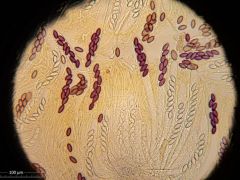 Ascobolus foliicola H20 40x