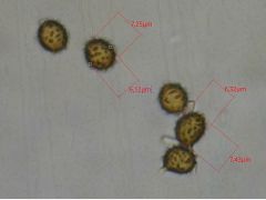 Spórák Melzer-reagensben